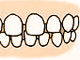 空隙歯列（すきっ歯）